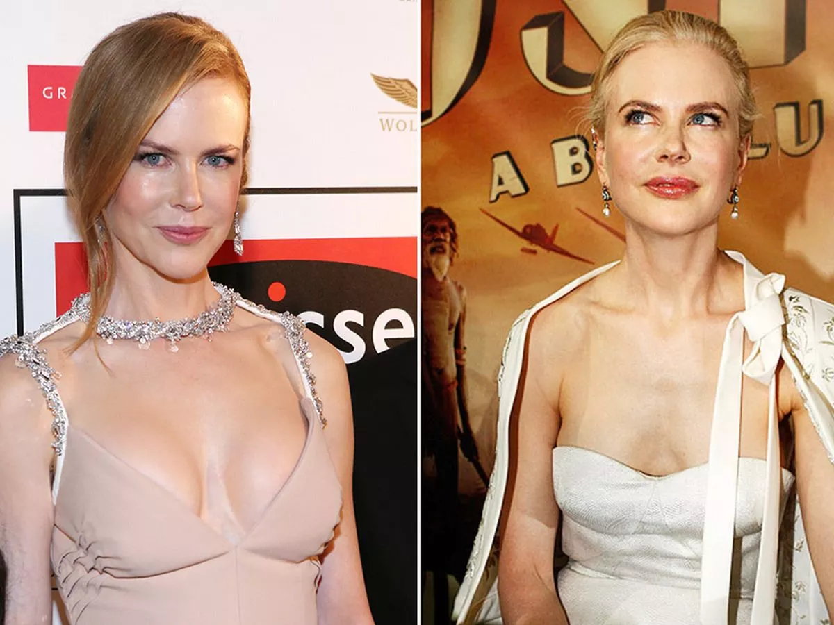 al dees add nicole kidman titties photo