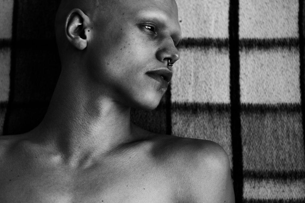 alexandro aguilar add bald twinks photo