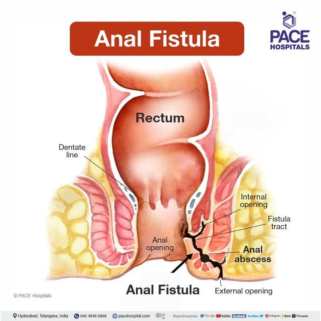 antony santhosh add high def anal image